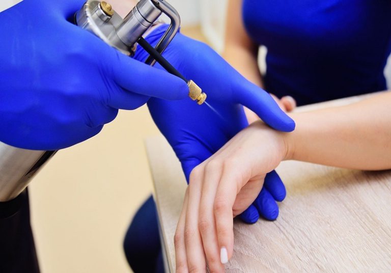 کرایوتراپی