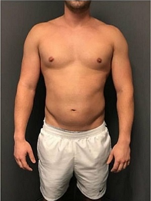 لاغری در اصفهان 3 a1