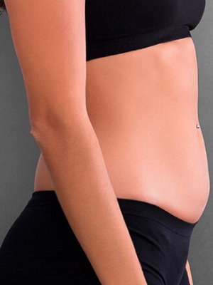 لاغری در اصفهان 5 a7