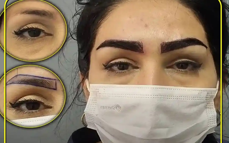 آزمایشات لازم قبل از کاشت ابرو شامل چه مواردی میشود؟ 1 چرا آزمایشات لازم قبل از کاشت ابرو اهمیت دارند؟