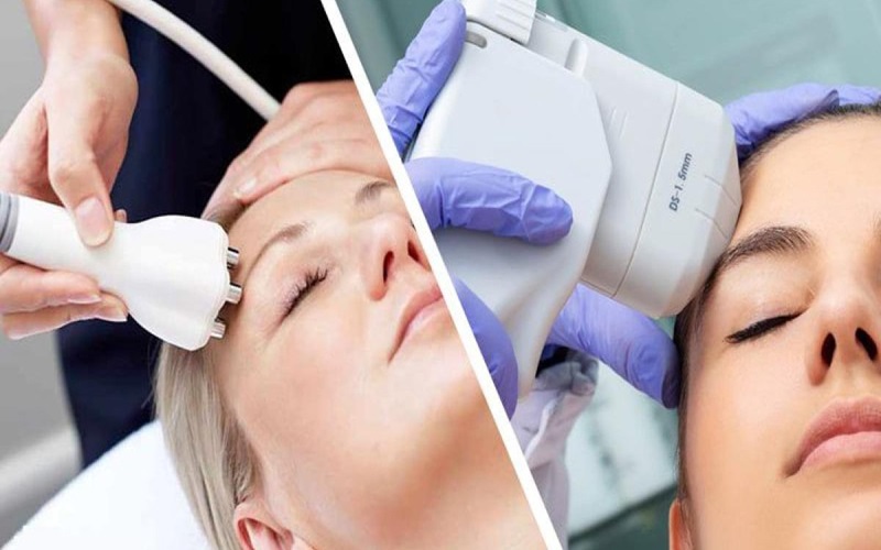 آر اف فرکشنال بهتر است یا هایفوتراپی؟ | مقایسه آر اف و هایفو 1 آر اف فرکشنال چیست