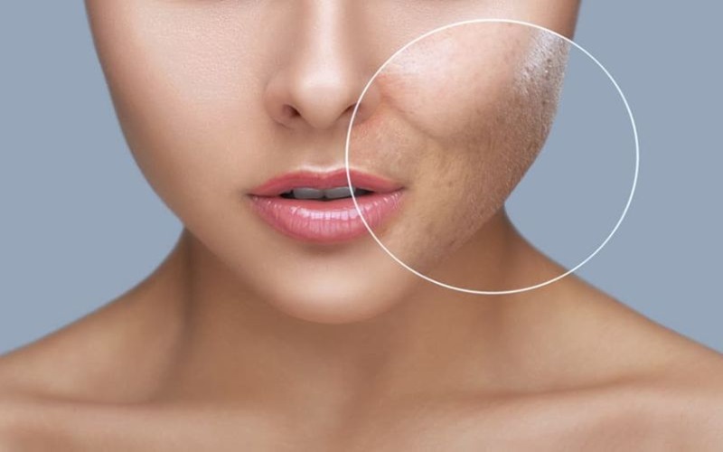 سابسیژن با اندولیفت چیست و چه کاربردی دارد؟ 3 سابسیژن با اندولیفت و لیفت صورت