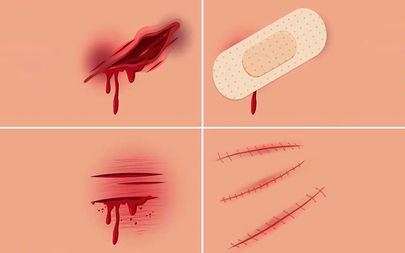 راهکارهایی برای زودتر خوب شدن زخم 3 ترک عادات مضر مانند سیگار و الکل