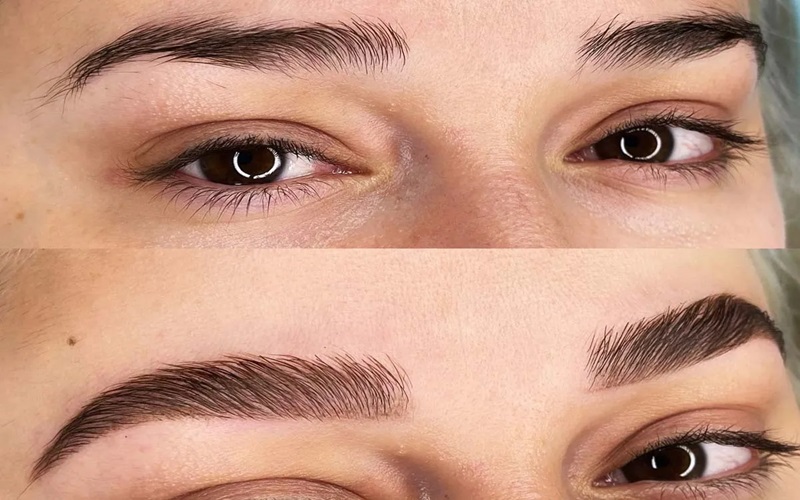 آیا کاشت ابرو عوارض دارد؟ | کاشت ابرو برای چه کسانی ضرر دارد؟ 1 کاشت ابرو چیست؟