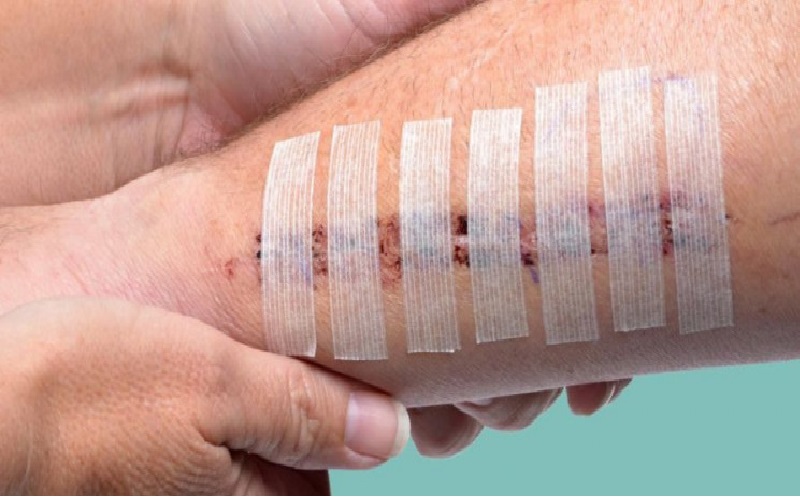 راهکارهایی برای زودتر خوب شدن زخم 1 شناخت دقیق روند خوب شدن زخم