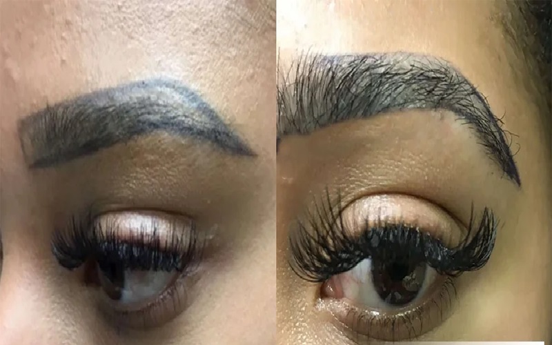 کاشت ابرو به روش میکروگرافت چیست؟ + هزینه و مزایا 1 کاشت ابرو به روش میکروگرافت چیست؟