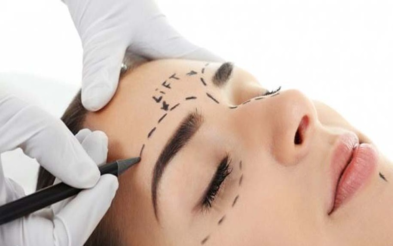 کاشت ابرو چگونه انجام میشود؟ - مراحل کاشت ابرو با جزییات 3 کاشت ابرو به روش Micro FUE