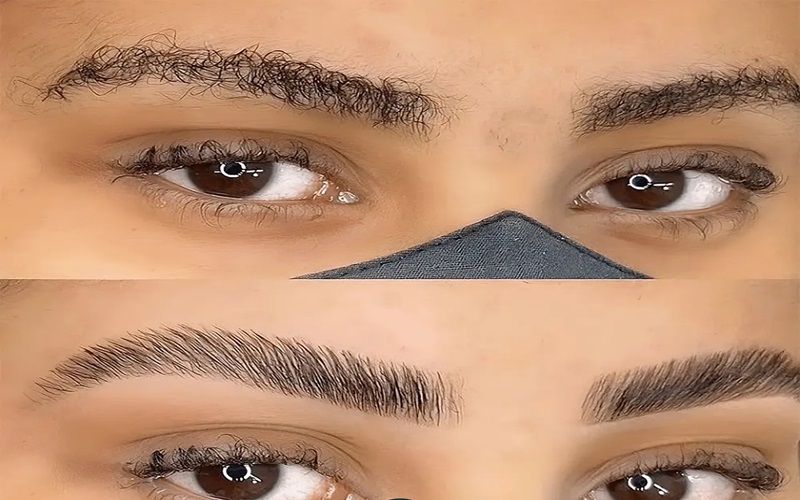 کاشت ابرو با بانک موی دیگران قابل انجام است؟ بررسی کامل روش، مزایا و معایب 1 کاشت ابرو با بانک موی دیگران