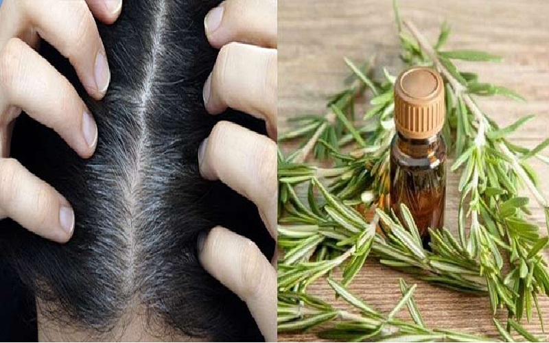 آیا روغن رزماری بر رشد مو موثر است؟ 3 نکات مهم هنگام استفاده از روغن رزماری