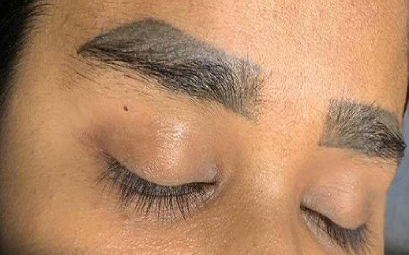 کاشت ابرو روی تاتو و مزایا و معایب آن | راهنمای کامل 2 معایب و چالشهای کاشت ابرو روی تاتو