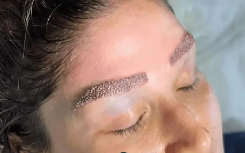 دلمه های پس از کاشت ابرو و مراقبتهای آن | راهنمای کامل 1 دلمههای پس از کاشت ابرو چیست؟