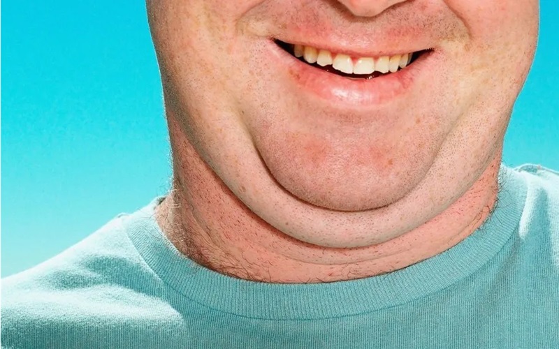 ۱۵ روش از بین بردن غبغب در خانه 3 جویدن آدامس بدون قند