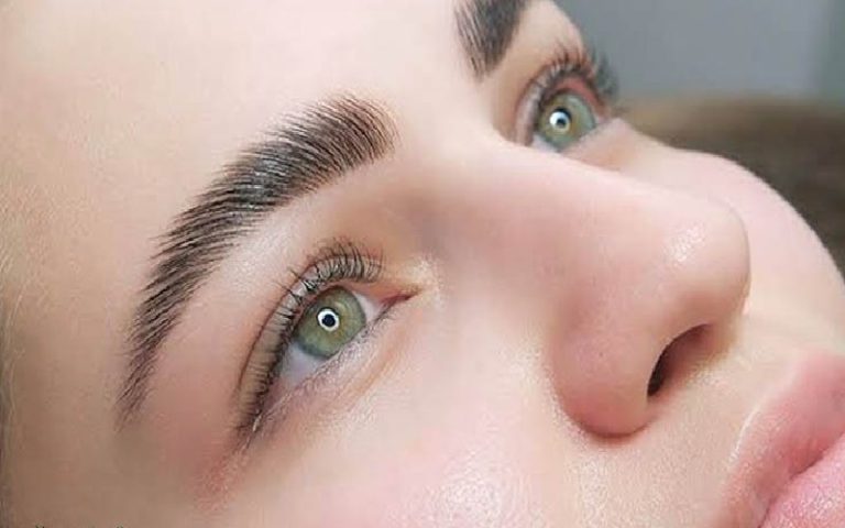 کاشت ابرو به روش SUT