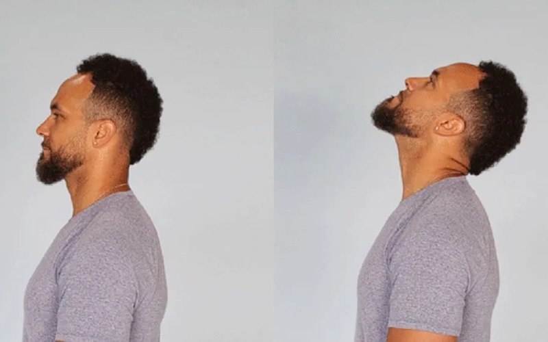 ۱۵ روش از بین بردن غبغب در خانه 1 تمرینات صورت برای تقویت عضلات