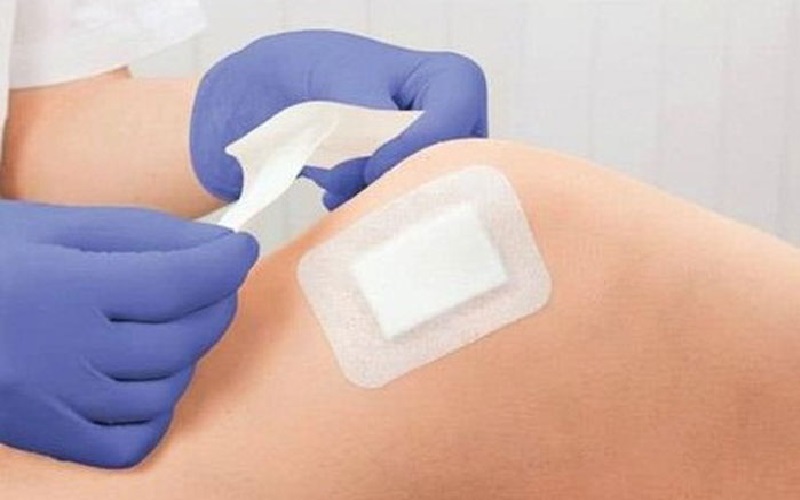 انواع پانسمان زخم بستر: اطلاعات ضروری برای بیماران و مراقبین 2 پانسمان فوم (Foam Dressing)