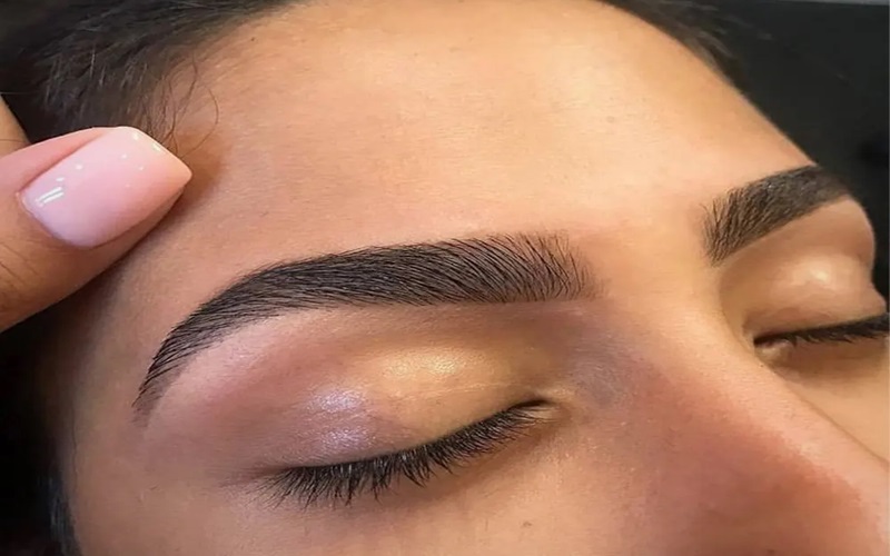 کاشت ابرو چگونه انجام میشود؟ - مراحل کاشت ابرو با جزییات 2 کاشت ابرو به روش FIT