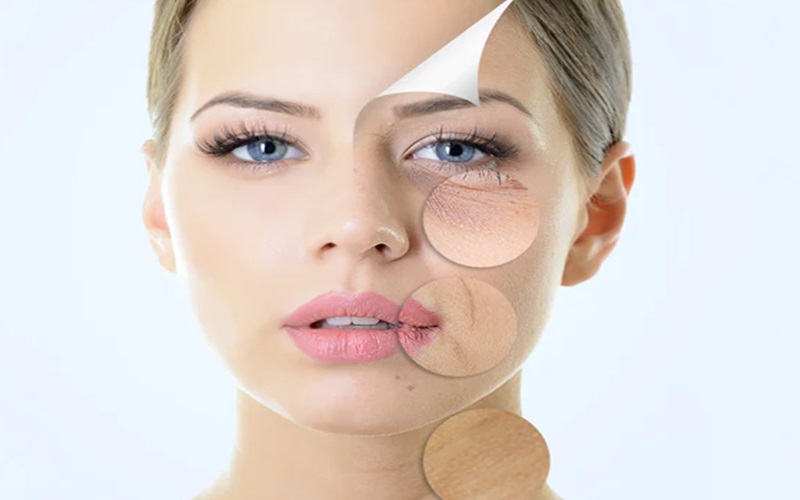 اندولیفت بهتر است یا هایفو؟ | مقایسه هایفوتراپی و اندولیفت 2 مقایسه هایفوتراپی و اندولیفت از نظر ماندگاری