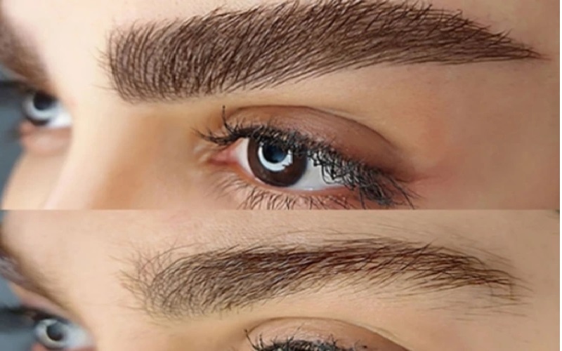 دلایل و درمان ورم بعد از کاشت ابرو | راهنمای کامل مراقبتها 3 مدت زمان ورم بعد از کاشت ابرو