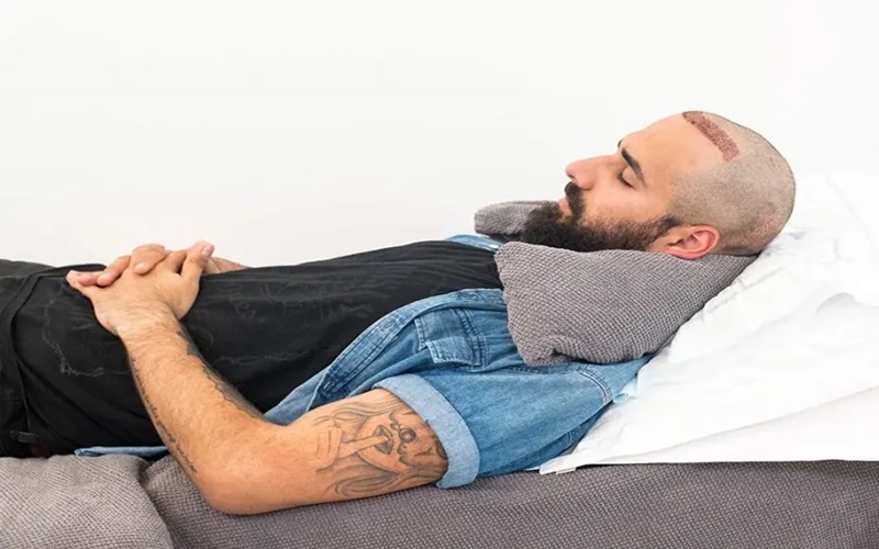 اهمیت نحوه خوابیدن بعد از کاشت مو 1 نحوه خوابیدن بعد از کاشت مو