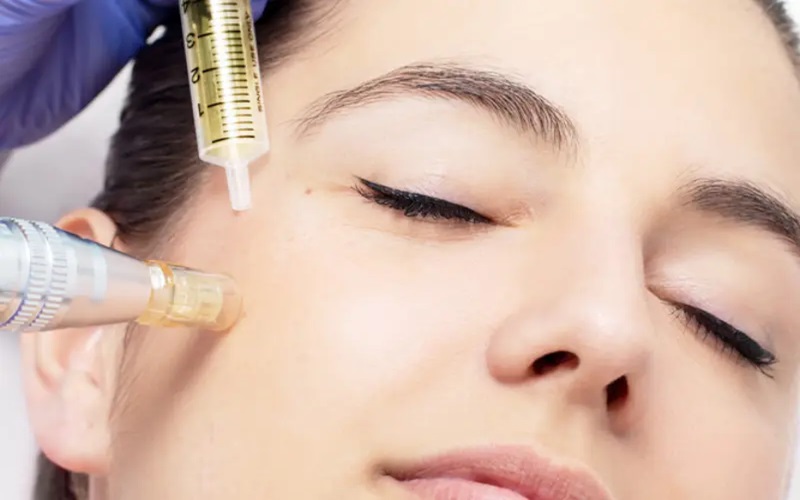 مزوتراپی صورت چیست؟ مزایا، عوارض، هزینه و کاربردها 3 عوارض احتمالی مزوتراپی صورت