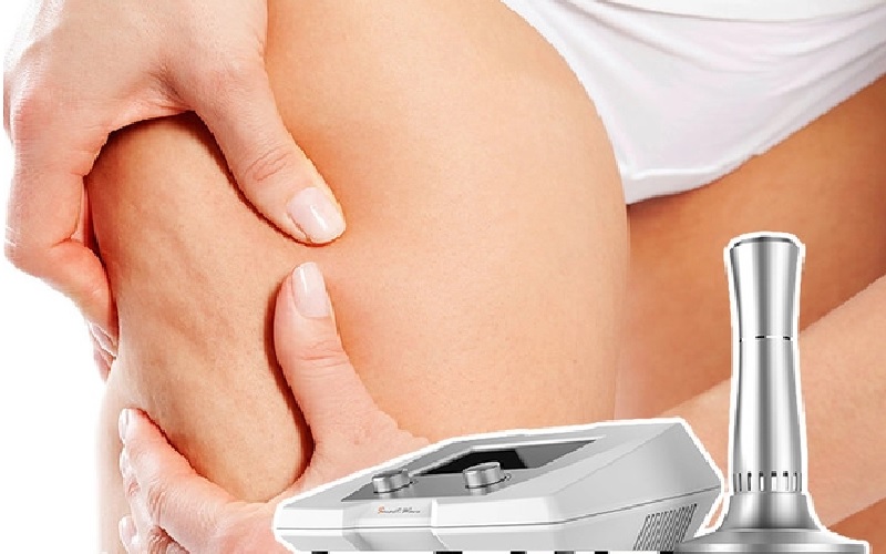 11 روش درمان سلولیت خانگی و کلینیکی 3 موج درمانی آکوستیک (Acoustic Wave Therapy)