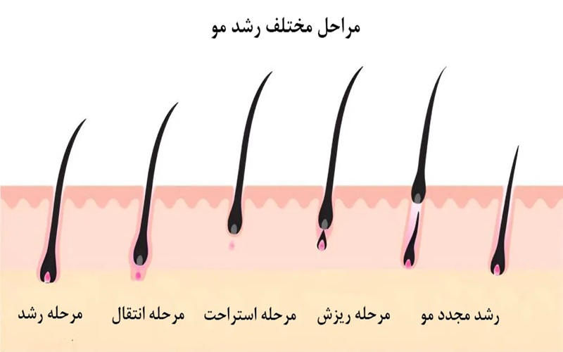 ساختار مو و مراحل رشد مو ؛ از ریشه تا زیبایی 2 ارتباط ساختار مو با ریزش و کاشت مو