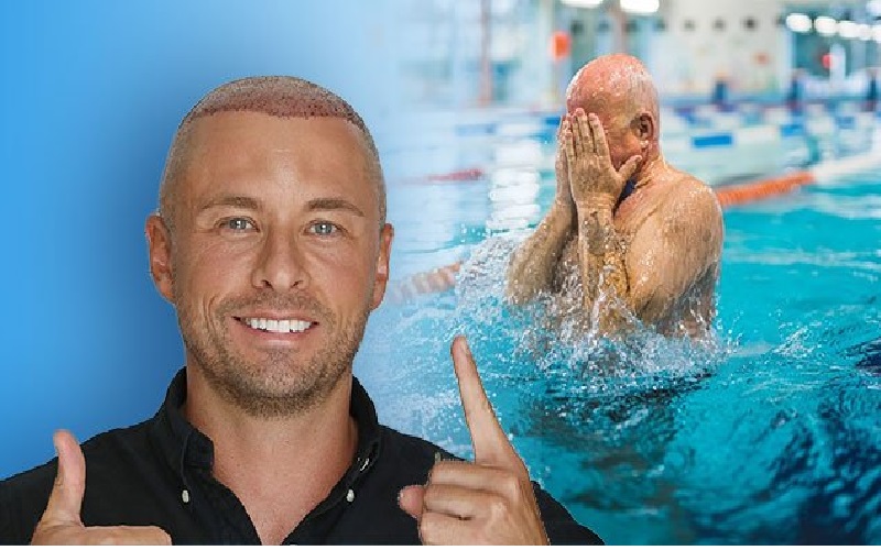 ممنوعیات پس از کاشت مو: نکات حیاتی برای بهبودی سریع و نتیجه طبیعی 3 شنا و سونا