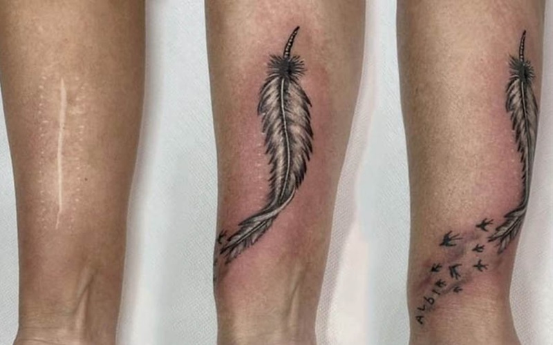 آموزش پاک کردن تتو در اصفهان: راهنمای کامل برای حذف تتو به صورت ایمن 1 چرا افراد به دنبال پاک کردن تتو هستند؟