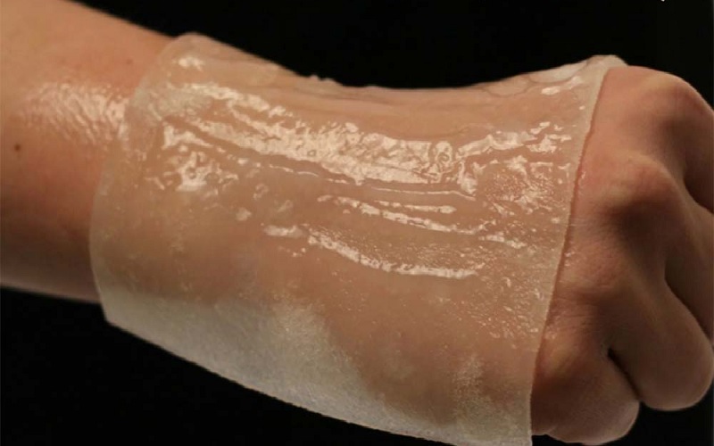 انواع پانسمان سوختگی: راهنمای جامع انتخاب بهترین پانسمان برای هر نوع سوختگی 1 سوختگی چیست و چرا پانسمان آن حیاتی است؟