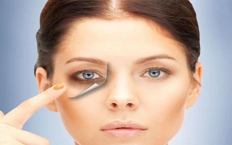 ۶ روش درمان خانگی پف زیر چشم؛ ساده، مؤثر و کاربردی 3 مکملها و تغذیه سالم