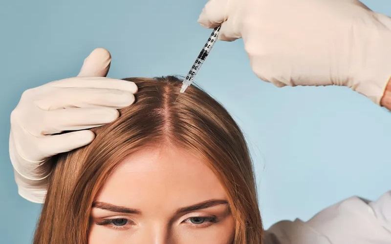 آیا مزوتراپی بعد از کاشت مو در رشد موها موثر است؟ بررسی کامل علمی و عملی 3 نکات مهم قبل و بعد از مزوتراپی