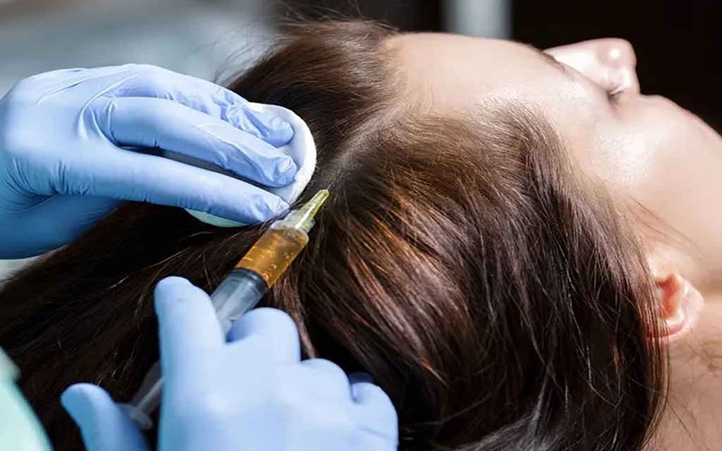 کربوکسی تراپی بعد از کاشت مو ؛ بهترین روش برای تقویت فولیکولها 3 عوارض احتمالی کربوکسی تراپی بعد از کاشت مو