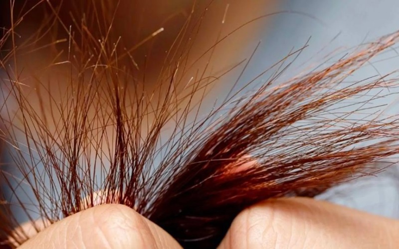 موخوره چیست و چگونه میتوان با آن مقابله کرد؟ 2 علل ایجاد موخوره