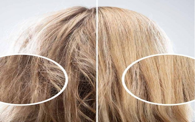 موخوره چیست و چگونه میتوان با آن مقابله کرد؟ 3 نکات تکمیلی درباره موخوره