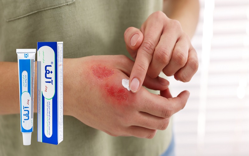 پماد برای از بین بردن جای زخم؛ معرفی بهترین کرمها و ژلهای ترمیمکننده 1 کرم آلفا؛ پماد محبوب و مؤثر برای ترمیم انواع زخم