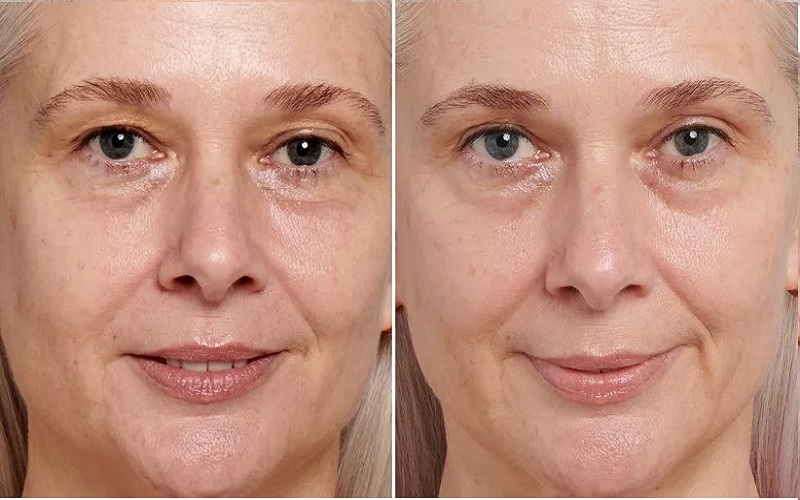 رتینول چیست و چه خواصی برای پوست دارد؟ 1 رتینول چیست؟