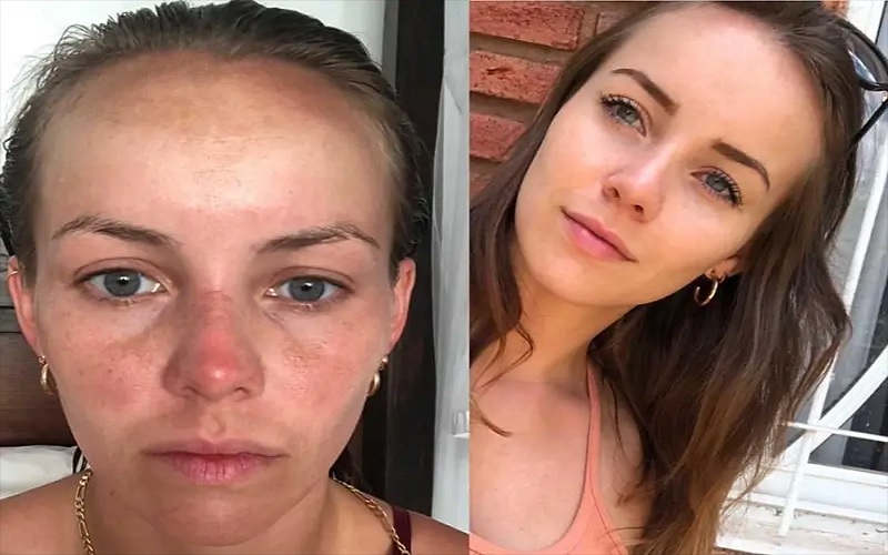 رتینول چیست و چه خواصی برای پوست دارد؟ 3 کاهش لکههای تیره و بهبود رنگ پوست