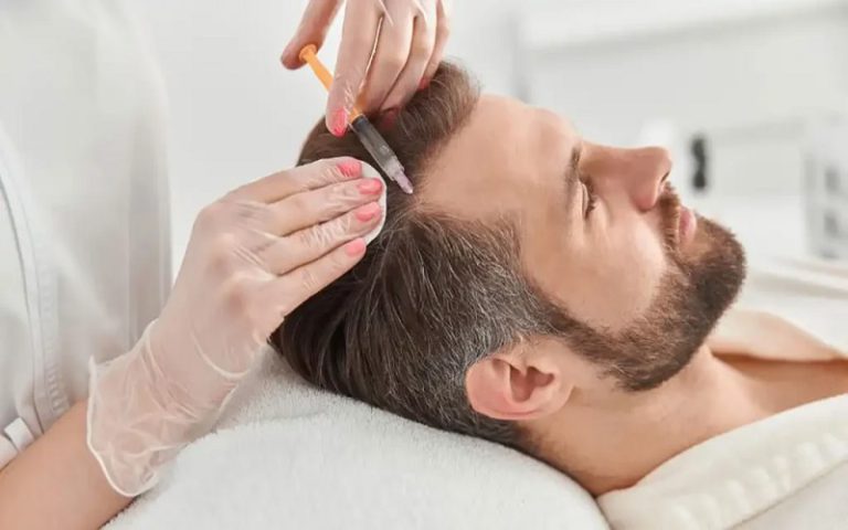 مراقبت بعد از مزوتراپی مو