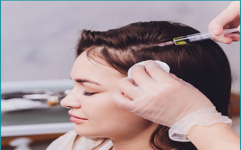 مراقبت بعد از مزوتراپی مو: ۱۰ نکته طلایی برای بهترین نتیجه و ماندگاری 2 ۱۰ نکته مهم مراقبت بعد از مزوتراپی مو که نباید فراموش کنید!