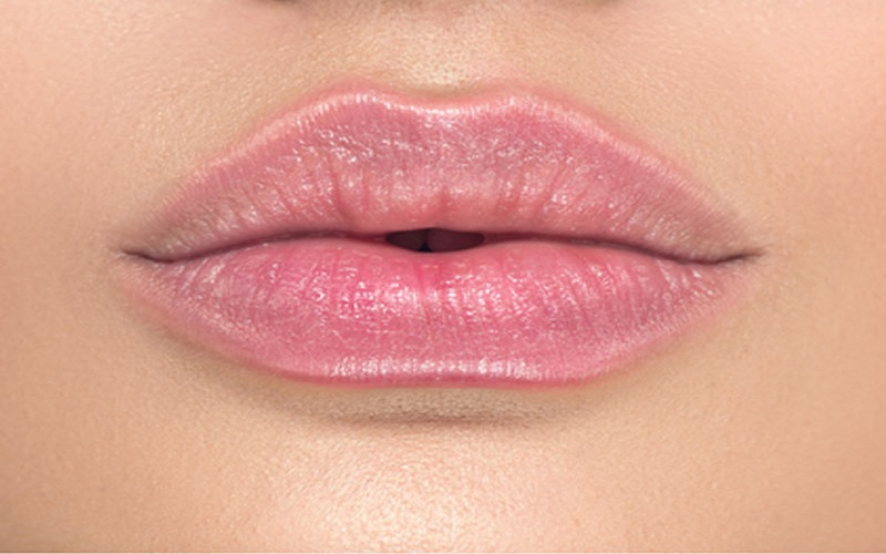 انواع تزریق ژل لب، مزایا، عوارض و انتخاب بهترین مدل 5 مدل باربی یا عروسکی (Barbie/Doll Lips)