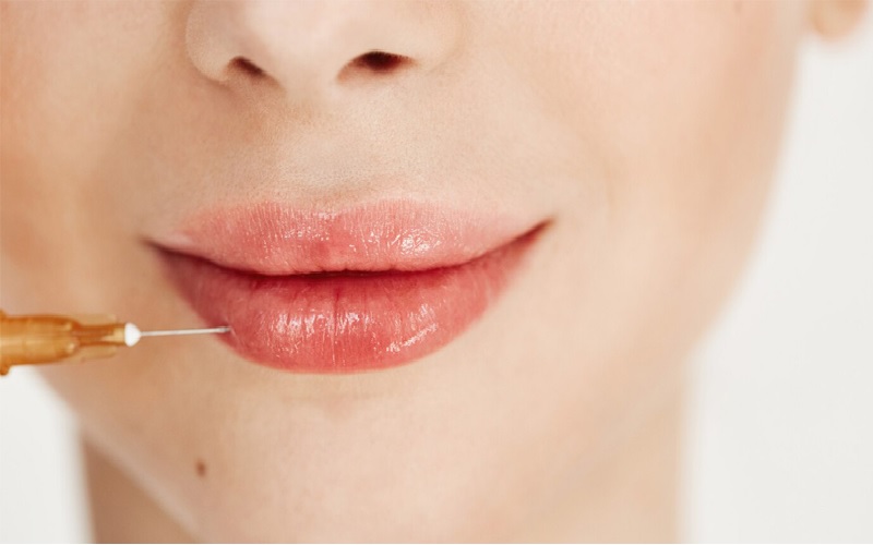 ژل لب بعد چند روز طبیعی میشه؟ راهنمای کامل برای داشتن لبهایی زیبا و طبیعی 1 فیلر یا ژل لب چیست؟ درک اساس کار